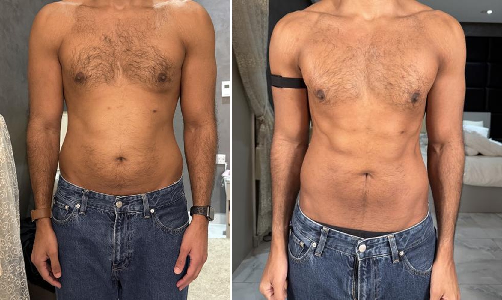 Anonymous client 01 before and after transformation